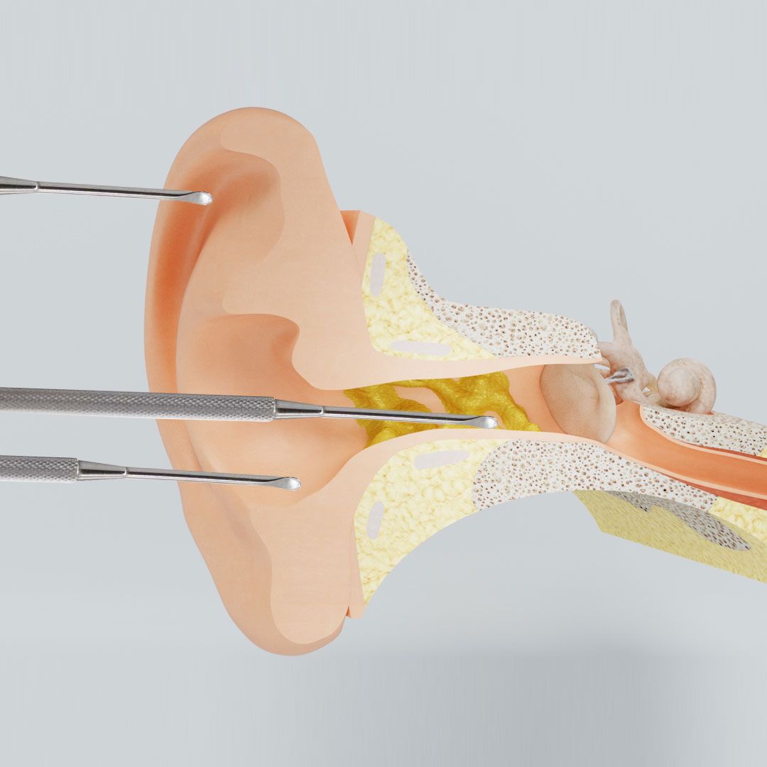 ReUseMe Ear Cleaning Tool / Ohr Reinigung