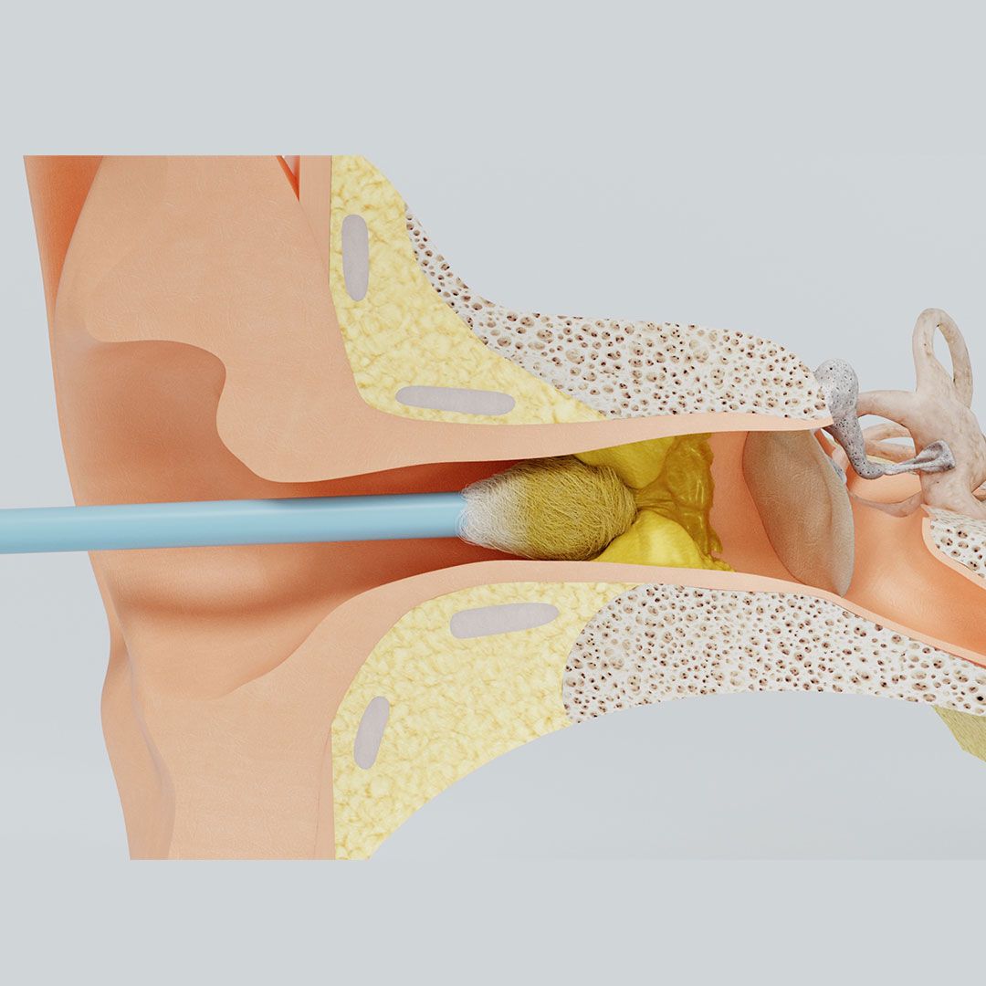 ReUseMe Ear Cleaning Tool / Ohr Reinigung